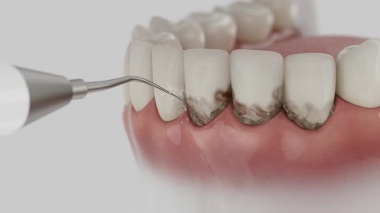 Trusted Emergency Dentist service in Atmore, AL - Dentist Open Now